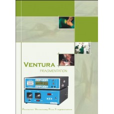 ZABBYS POSTERIOR VITRECTOMY + FRAGMENTATION Z-VIT-FRAG - PRICE INCLUDES PACKING AND FREIGHT ZABBYS POSTERIOR VITRECTOMY + FRAGMENTATION Z-VIT-FRAG - PRICE INCLUDES PACKING AND FREIGHT